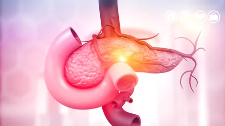 Boala imprevizibilă declanșată de mâncatul în exces care poate duce la moarte. Avertismentul unui medic gastroenterolog, de sărbători