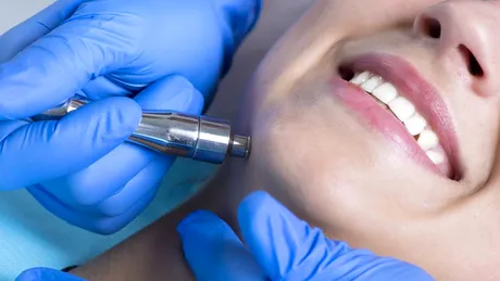 Tratamente anti-aging fără bisturiu: când sunt necesare?