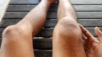 Dieta pentru bursită și tendinită. Cu ce să înlocuiești alimentele „păcătoase” să scapi de inflamație